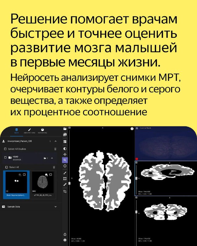 ```html
Ранняя диагностика ДЦП: 12 ключевых аспектов с помощью первого ИИ-решения для заболеваний ЦНС
``` 3 additional image 13
